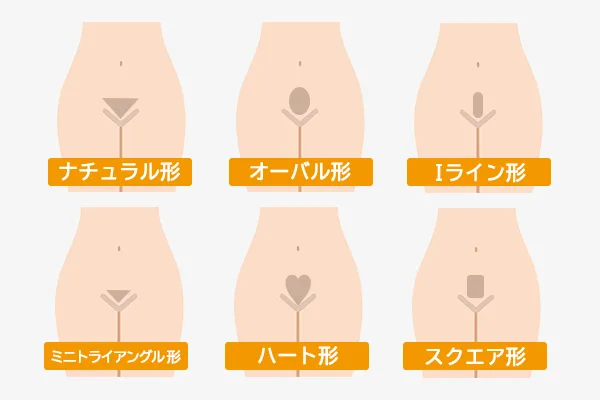 Vゾーンのアンダーヘアのデザイン例