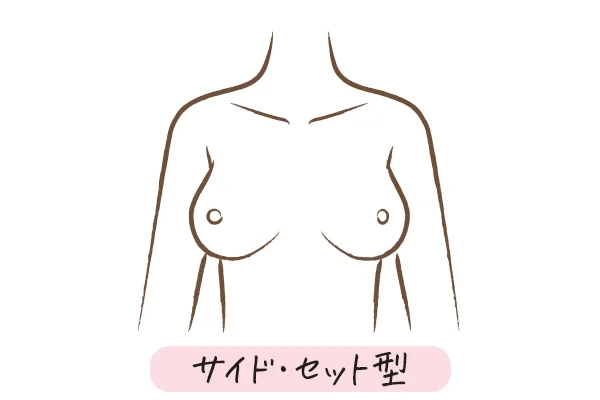 【イラスト】サイド・セット型のバスト