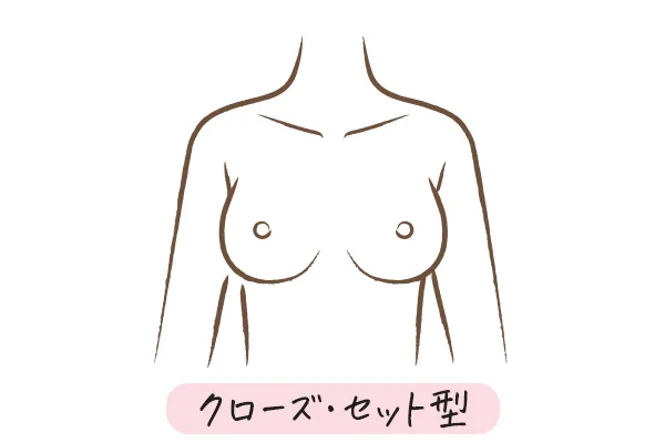 【イラスト】クローズ・セット型のバスト