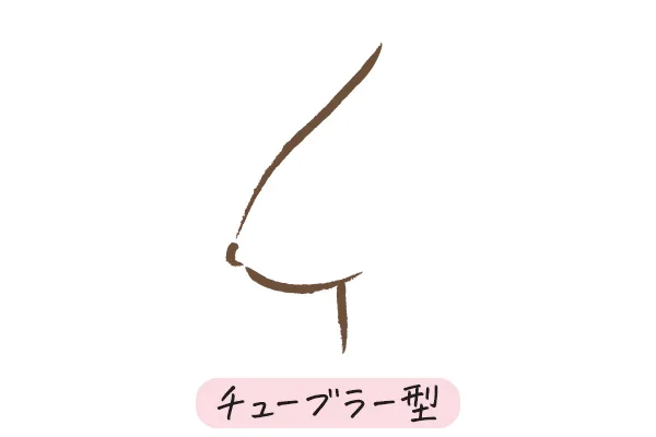 【イラスト】チューブラー型のバスト